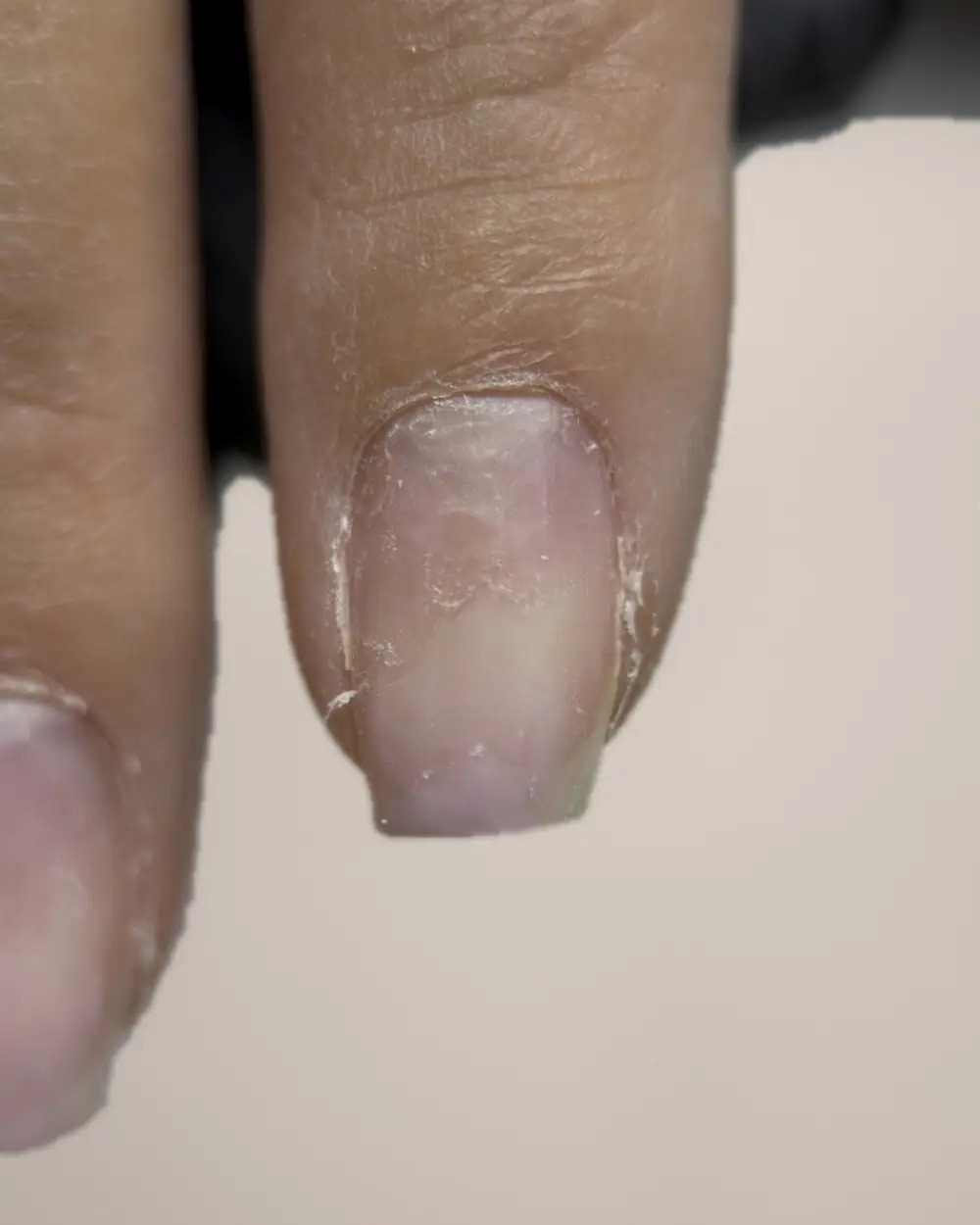 Before: overgrown cuticle and uneven nail